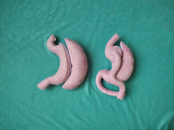 Estômago Bariátrico Pelúcia Modelo Anatômico Cirurgia Sleeve e bypass